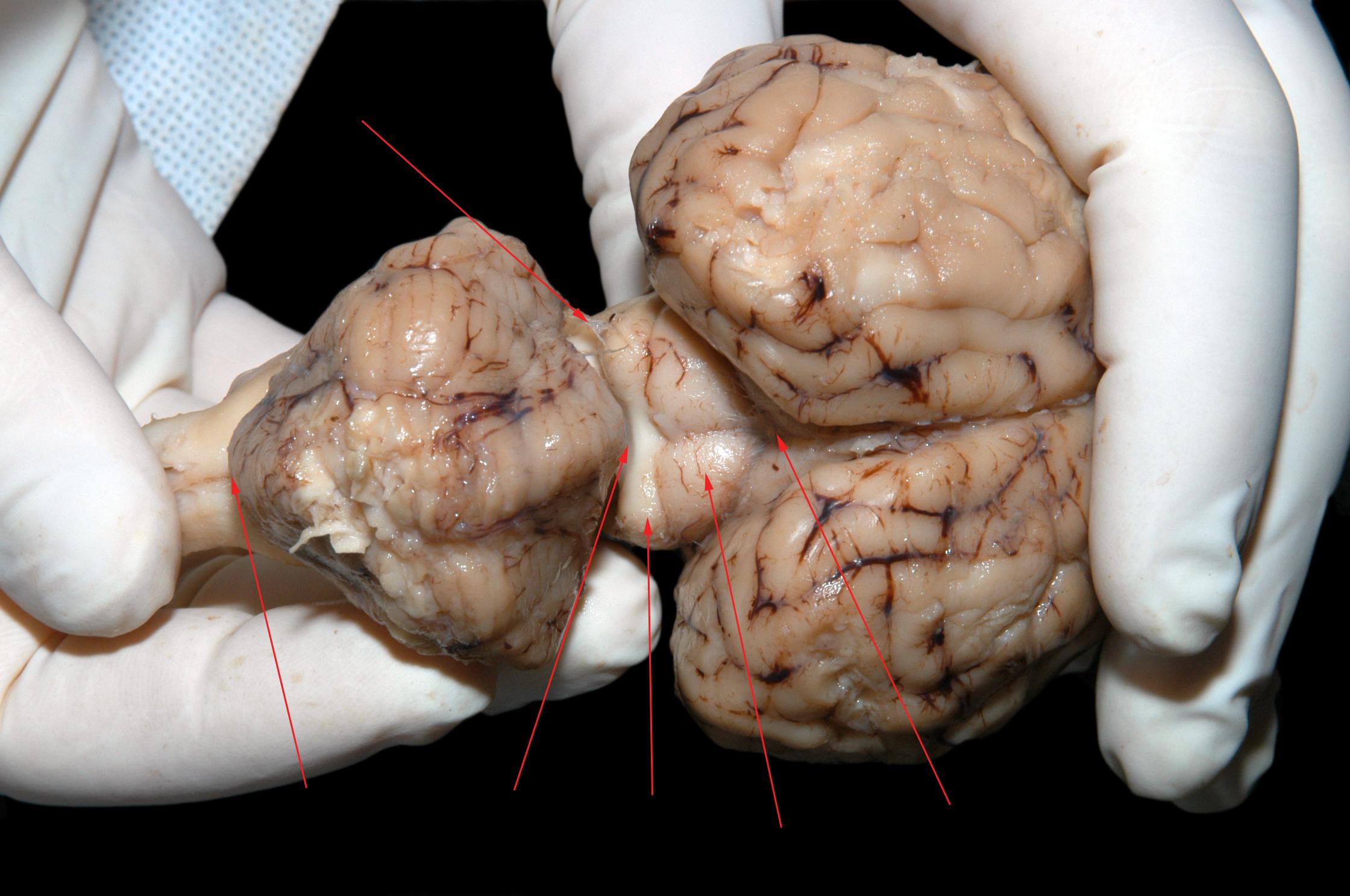 sheep cerebellum